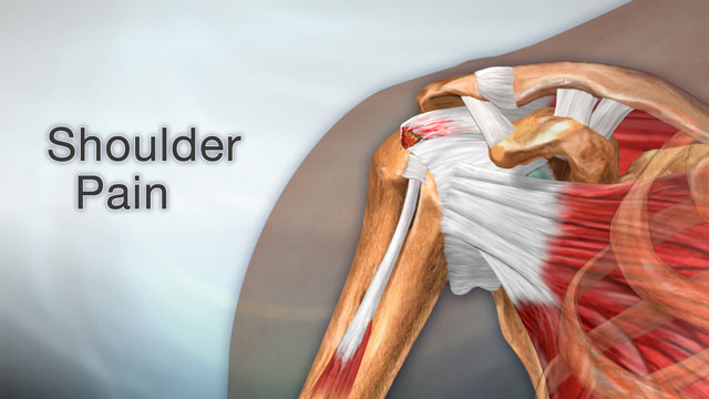 Shoulder Pain Anatomy - Human Anatomy